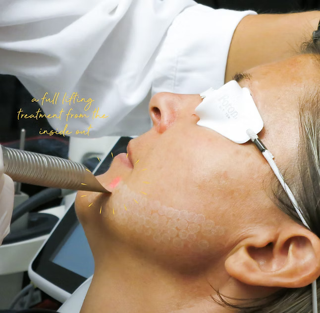 Laser Treatment